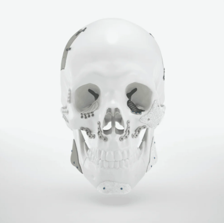 KLS Martin and Lithoz: nearly 500 patient-specific bioceramic implants